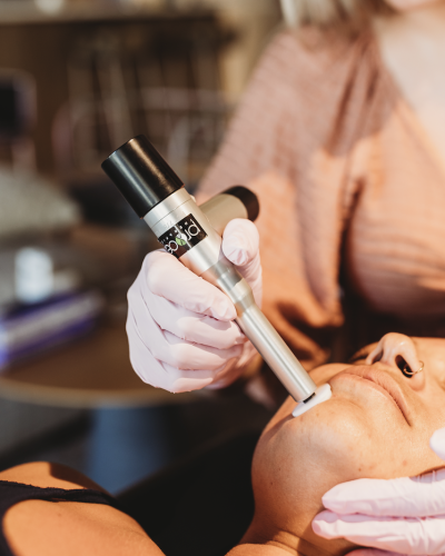 Procell Microchanneling Treatment